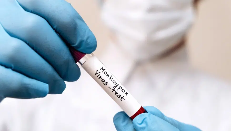 monkeypox testing