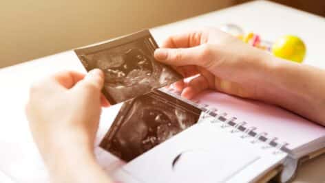 baby ultrasound parenthood