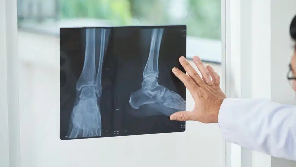 Malvern Medical Device Company Raises $1.8 Million for ‘Toe-tally’ New Product