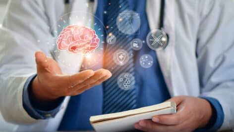 doctor with Alzheimer's concept. brain in hand