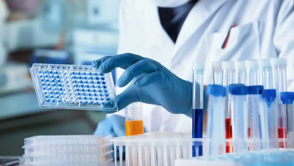 Researcher working with microplate panel for diseases diagnosis in the laboratory. Doctor working with microplate
