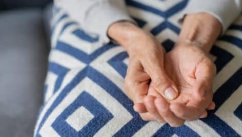 older woman holding her hands