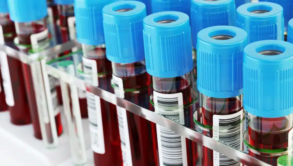 Blood test tubes. Blood samples in a rack.
